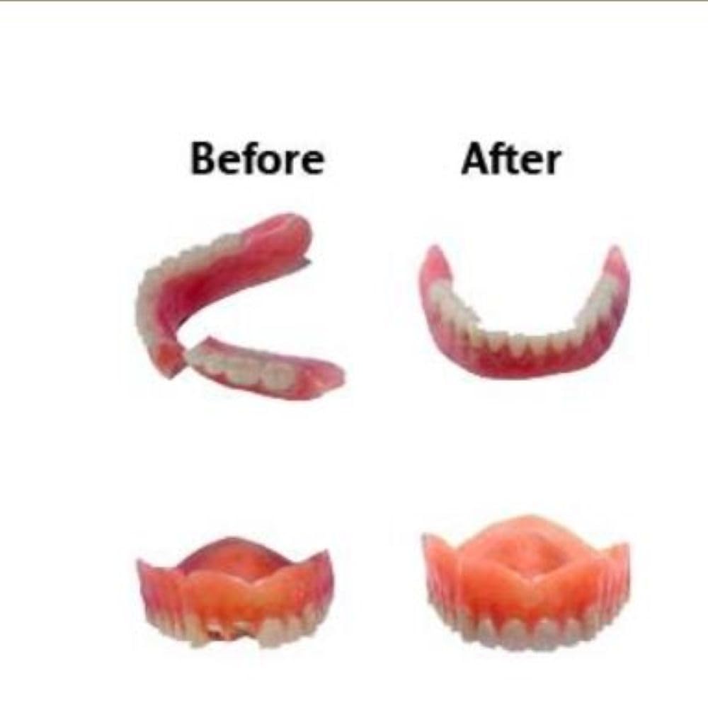 Professional Grade Denture Repair Kit Glue L31735