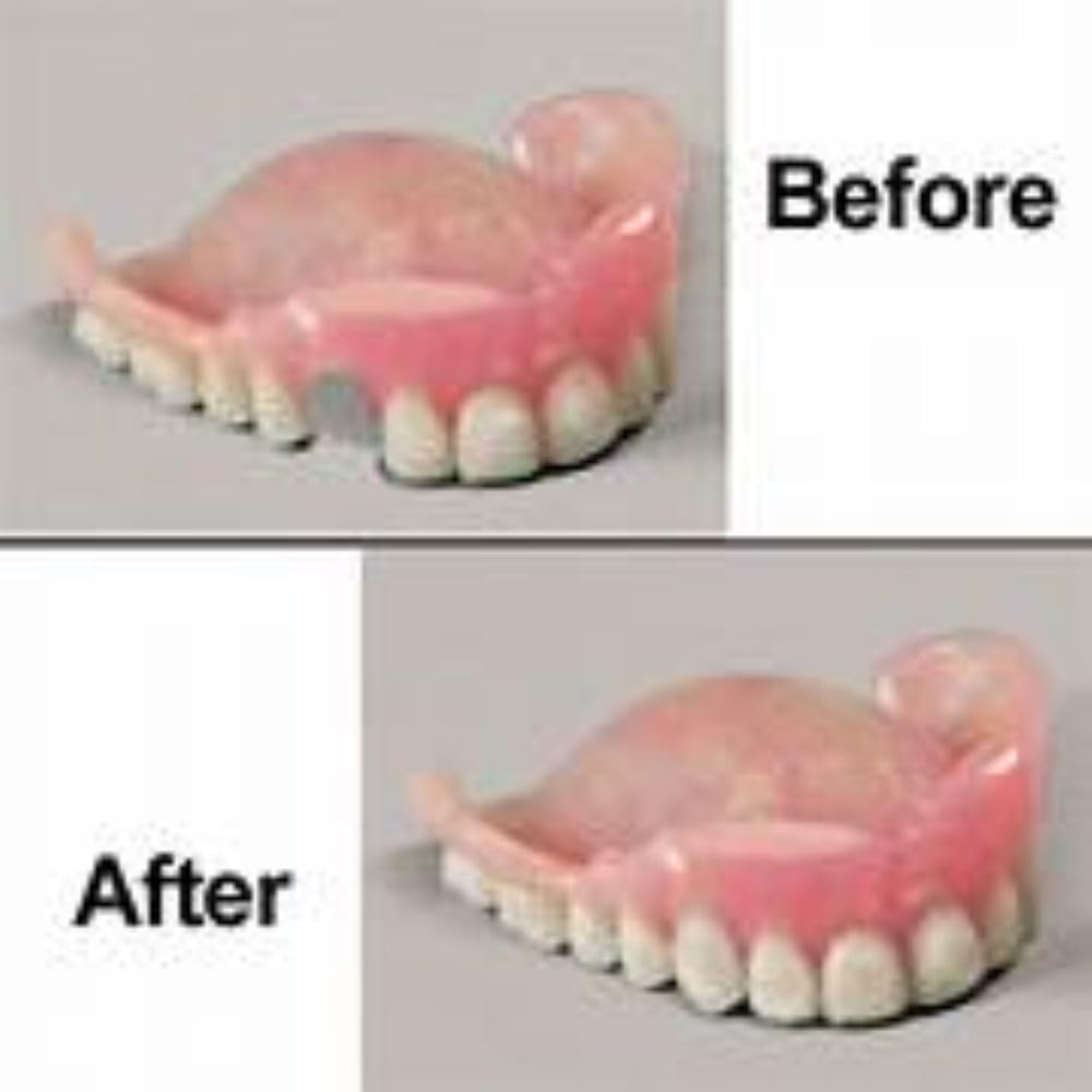 Professional Grade Denture Repair Kit Glue L31735